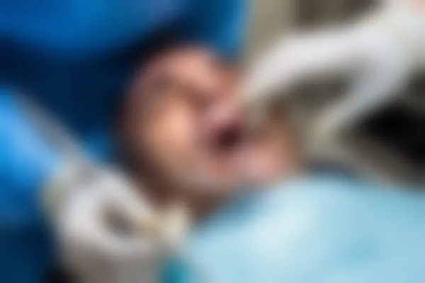 优惠价仅需2500元起，景德镇文明口腔门诊部口腔颌面外科具体费用为3000元起。