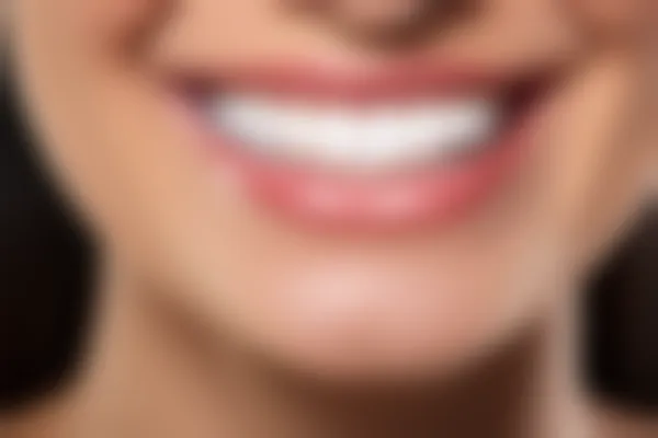 北京青苗儿童口腔(火器营店)牙齿美白服务现价仅需600元起，原价800元起，快来查看我们的优惠价目表，体验超值服务！