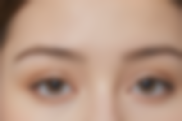 100度近视应该如何进行有效治疗？有哪些方法可以帮助改善视力？