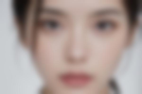 双眼皮手术：埋线与全切哪个更好？优缺点、费用及效果全面解析