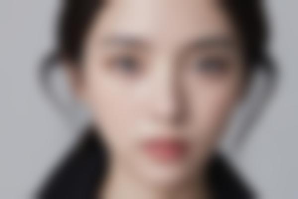 深圳郭京京医生面部雕刻与微整形实力解析，塑造自然美感！