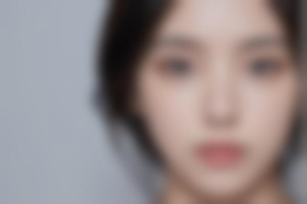面部年轻化与脂肪填充特色