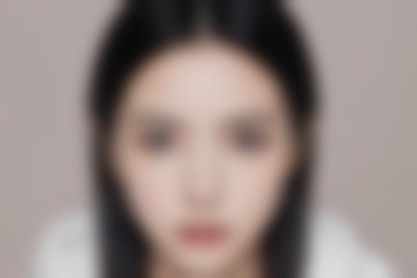 益阳格莱美袁亮飞医生整形技术获赞，二十年经验打造个性化美丽方案