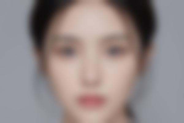 张勇