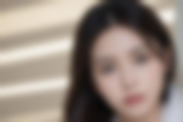 郑州崔双全医生整形技术怎么样？超精细手法+3000例手术经验，自然隐痕太绝了！
