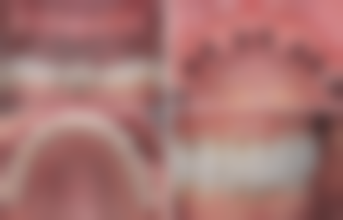 长沙美蒂斯口腔收费价格表