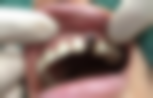 大连康仁德口腔门诊部收费价格表