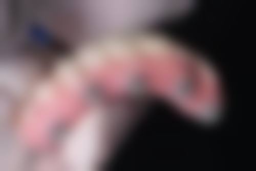 耿成虎医生项目收费价格