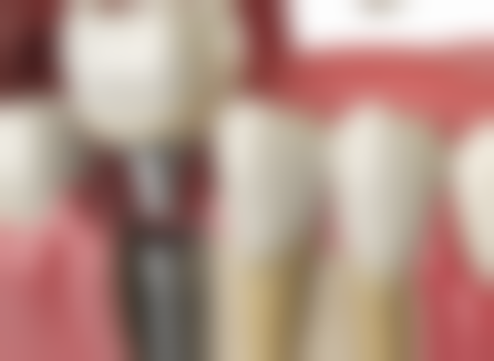 北京海贝口腔诊所收费价格表