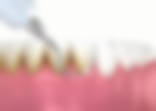 赵雪丽医生项目收费价格