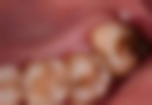 李艳萍医生技术优势