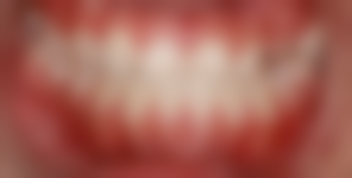 彭晓琍医生口碑评价及反馈内容