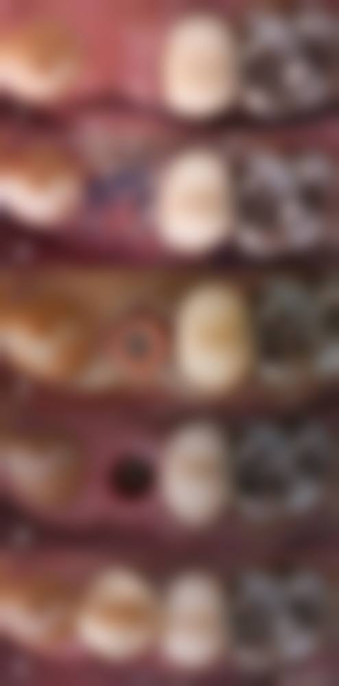 周蔚医生技术优势