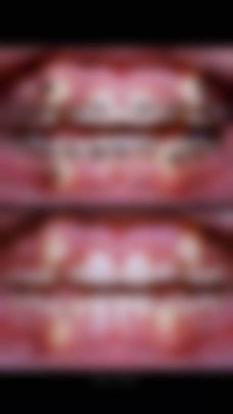 重庆九龙坡摩尔口腔门诊部收费价格表