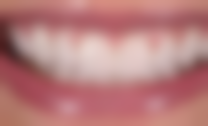 赵雪丽医生技术优势