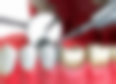 李艳萍医生项目收费价格