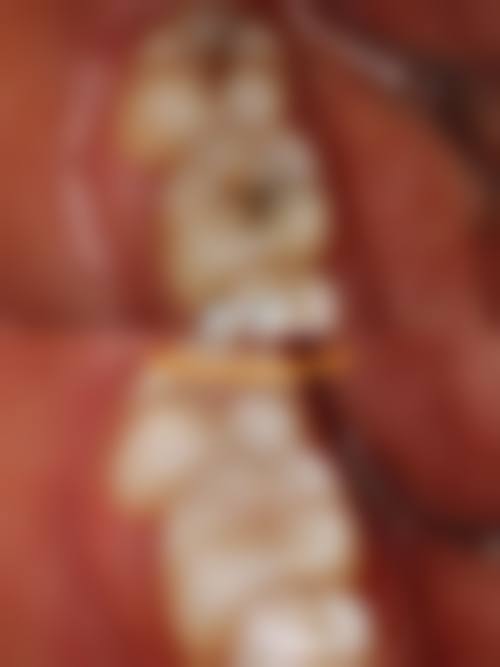 南通恒美口腔预约挂号方式