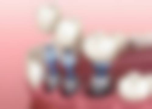 西安爱尚美口腔（浐灞分院）特色诊疗项目与技术优势