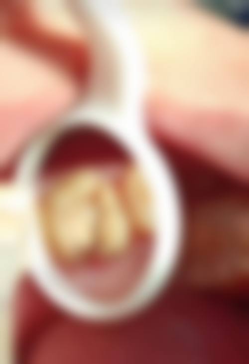 刘英群医生技术优势