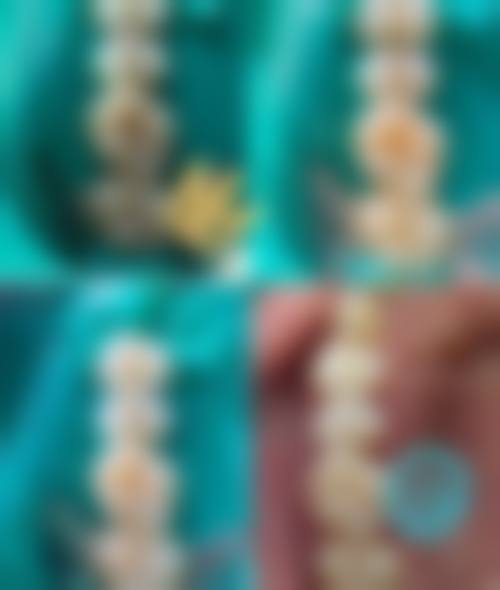 淄博张店向前口腔特色诊疗项目与技术优势