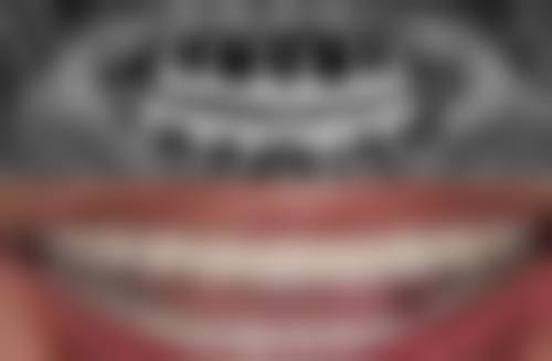 三亚市人民医院口腔科地址电话、营业时间