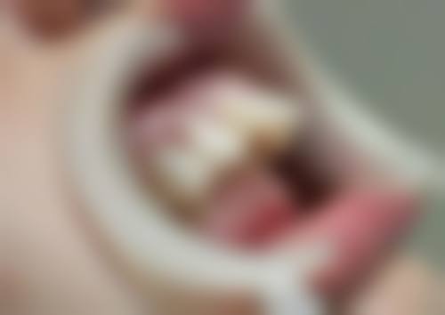 贵州中 医 药大学第一附属医院丁维医生项目收费价格