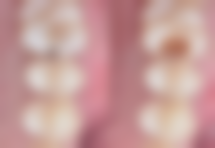 丁维医生（贵州中 医 药大学第一附属医院）技术优势