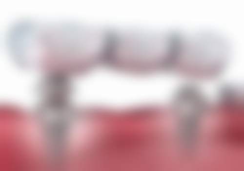 深圳格伦菲尔口腔（龙华清湖）收费价格表