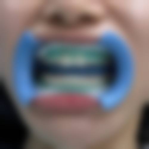 景德镇珠山区峻松口腔门诊部收费价格表