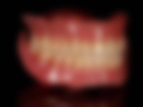 兰州碧莲盛植发韩伟医生预约挂号