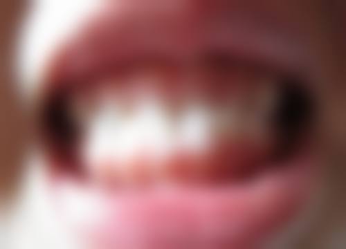 候喜朋医生项目收费价格