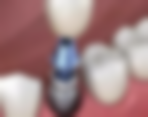 丁宇航医生预约挂号