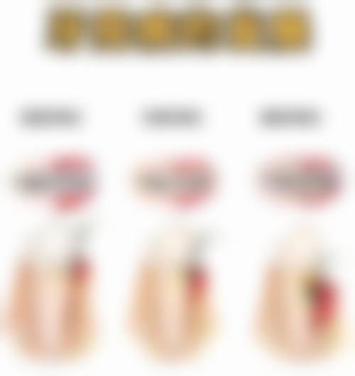 张惠医生技术优势