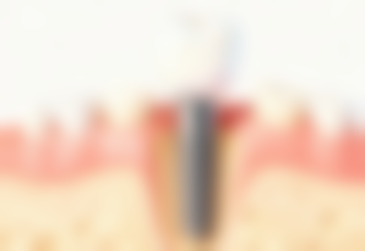 杭州牙科医院临平城南口腔医院收费价格表