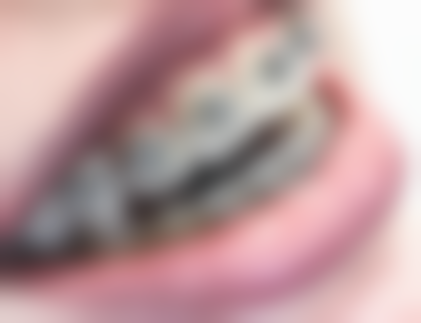 浙江大学医学校附属第二医院眼科韩伟医生技术优势