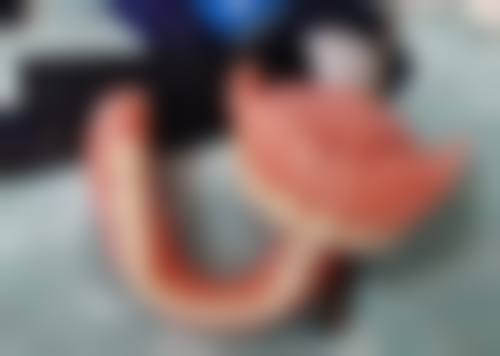 丁维（贵州中 医 药大学第一附属医院）医生技术优势