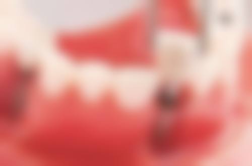 温州乐清吴乐飞口腔收费价格表