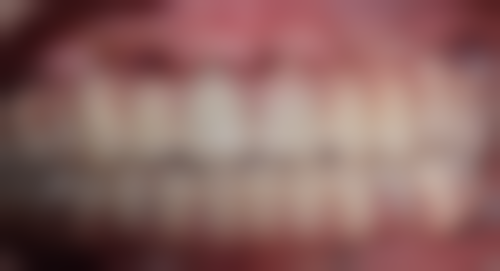 泉州市第一医院口腔科收费价格表