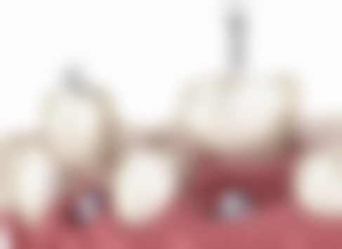 洛阳小天鹅口腔诊所收费价格表