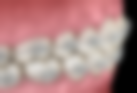 巨野县牙医乐口腔诊所收费价格表