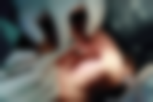 南京鼓楼医院孙旭医生项目收费价格