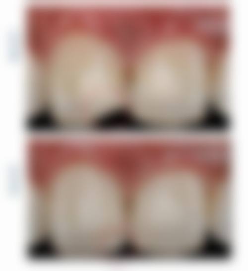 南平雅正口腔特色诊疗项目与技术优势