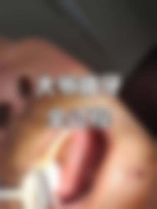 南京鼓楼医院孙旭医生项目收费价格