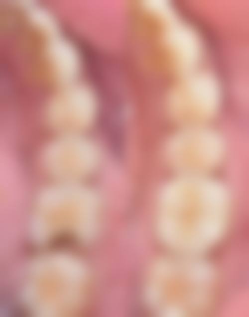 北京宣武医院孙旭医生技术优势