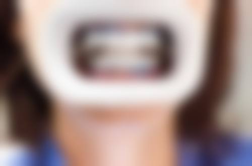 赵肖楠医生技术优势