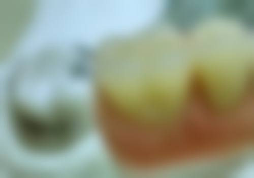 刘巧萍医生项目收费价格