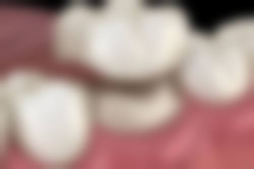 刘巧萍医生技术优势