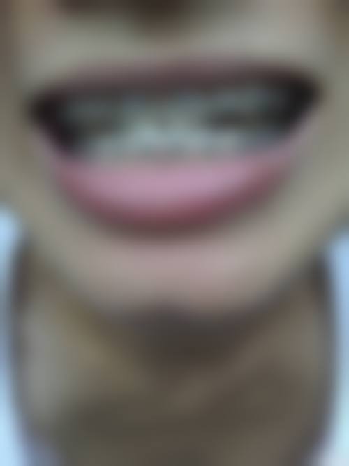 孙爽医生技术优势