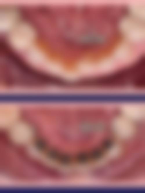 吉天添医生项目收费价格