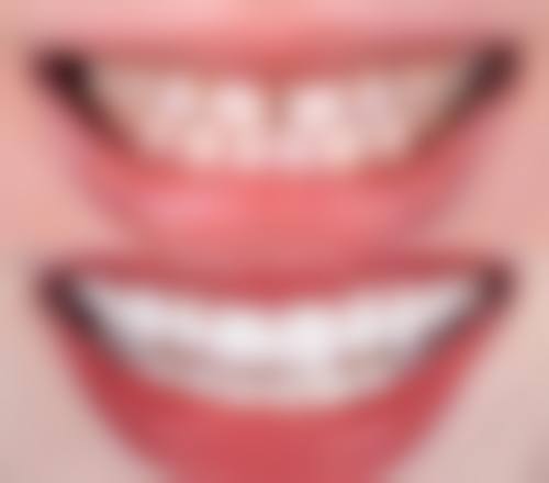 伍林穗医生技术优势